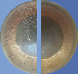 
Microscope image: Previously (left) spongy lime can settle. Later (right) stuck lime could come loose
